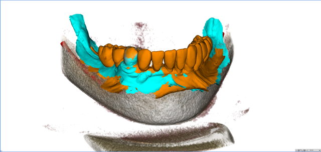 stackable-Fall mit Dr. Jan Spieckermann