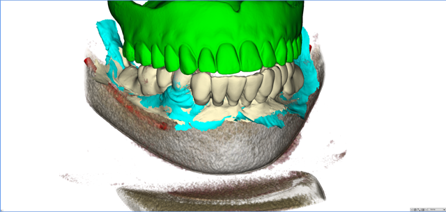 stackable-Fall mit Dr. Jan Spieckermann